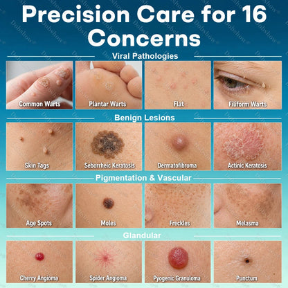 Healrize® 7-Day Blemish Remover, Painless and Scar-Free — Advanced Ballpoint Pen for Skin Tags and Spots
