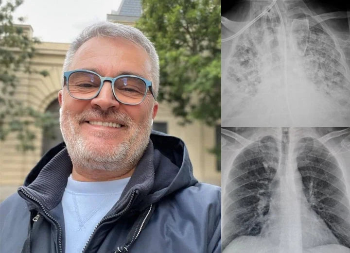 US👨‍⚕️✅ Dobshow® Botanical Mullein Lung Cleanse Diffuser 🌿(🫁Cough, Pharyngitis, shortness of breath, sputum, stuffy nose, bronchitis, bronchitis, allergy symptoms, lung discomfort💝)
