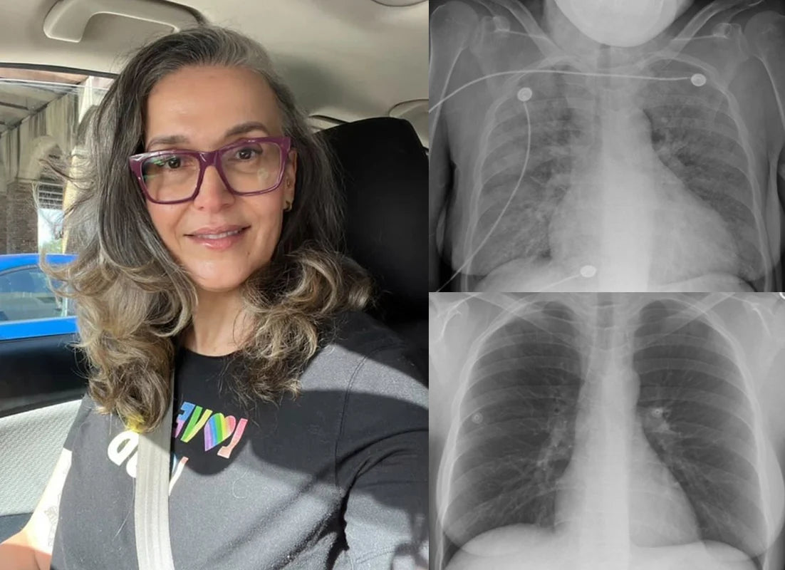 US👨‍⚕️✅ Dobshow® Botanical Mullein Lung Cleanse Diffuser 🌿(🫁Cough, Pharyngitis, shortness of breath, sputum, stuffy nose, bronchitis, bronchitis, allergy symptoms, lung discomfort💝)
