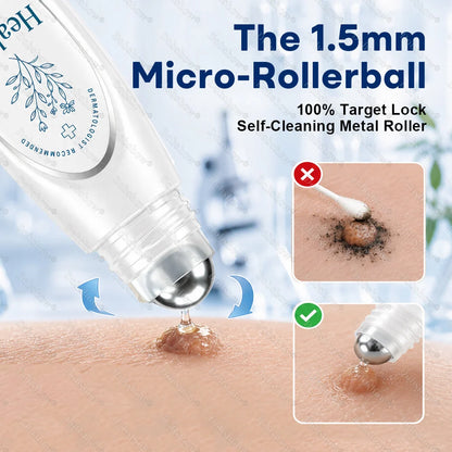 Healrize® 7-Day Blemish Remover, Painless and Scar-Free — Advanced Ballpoint Pen for Skin Tags and Spots
