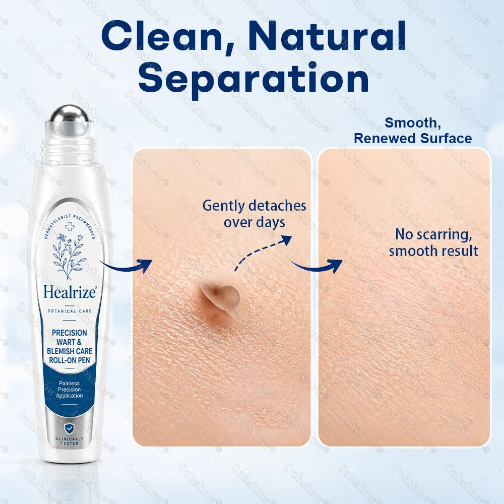 Healrize® 7-Day Blemish Remover, Painless and Scar-Free — Advanced Ballpoint Pen for Skin Tags and Spots