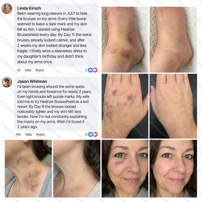 💥500K+ SOLD💕- Dobshow® Bruise Shield & Skin-Strengthening Cream