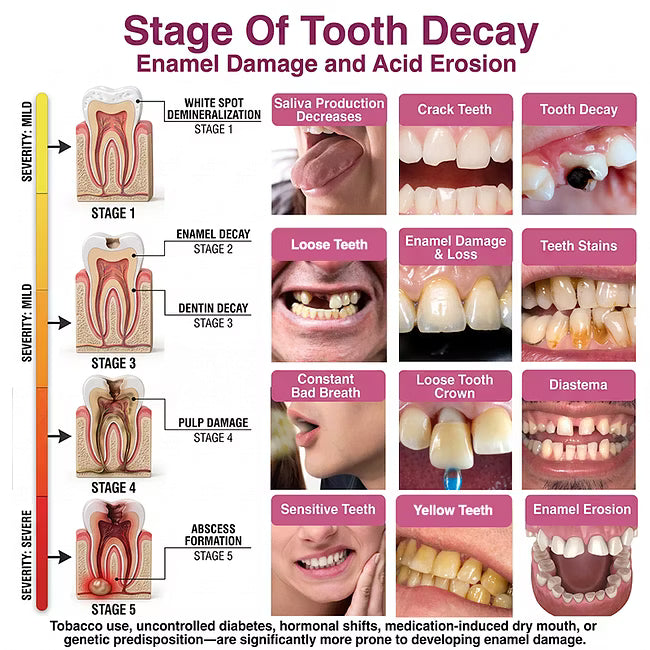 Dobshow® 🦷 DenPerm Cavity-Repair Advanced Enamel Filling Gel