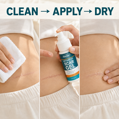 Dobshow® Advanced Scar Gel