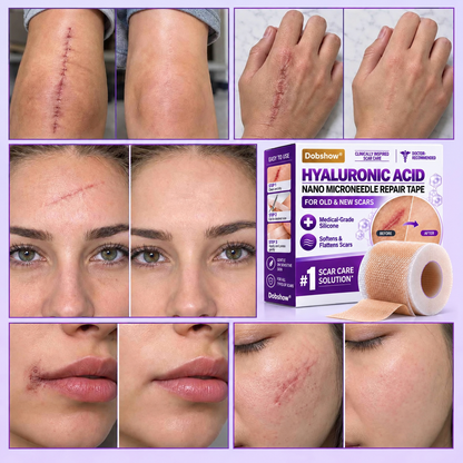 ✅Dobshow®Hyaluronic Acid Nano Microneedle Repair Tape for Surgical, C-Section, Raised & Stubborn Scars🏉