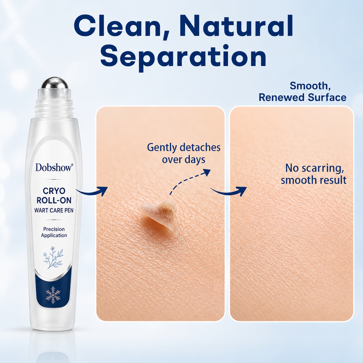 100K + Sold  | Dobshow® 7 -Day Wart & Blemish Remover